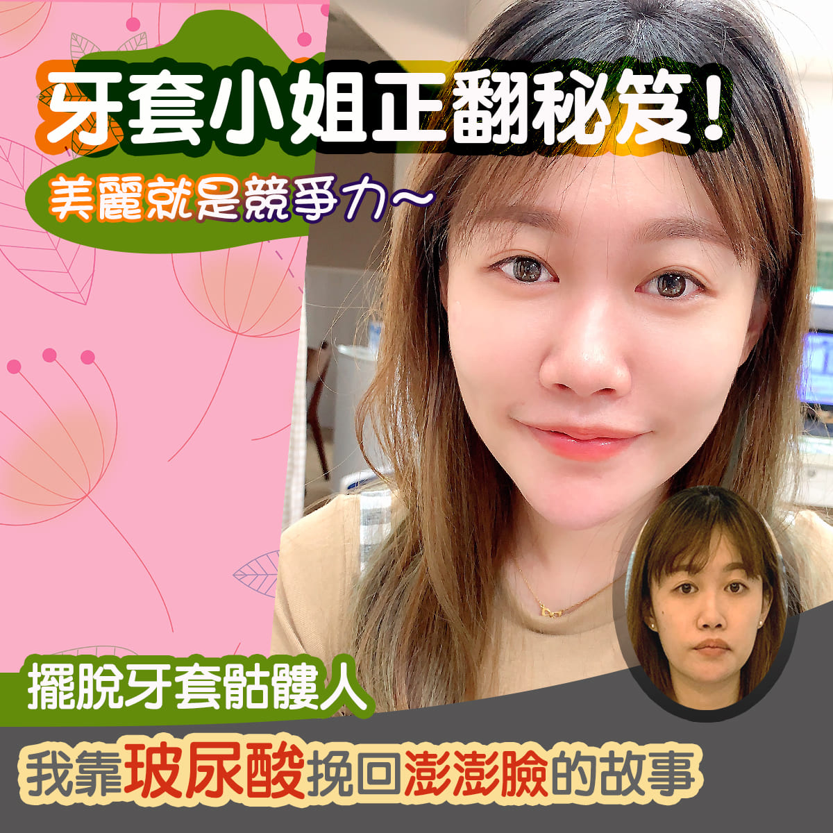 玻尿酸適應症 皮膚老化/魚尾紋/抬頭紋/皺眉紋